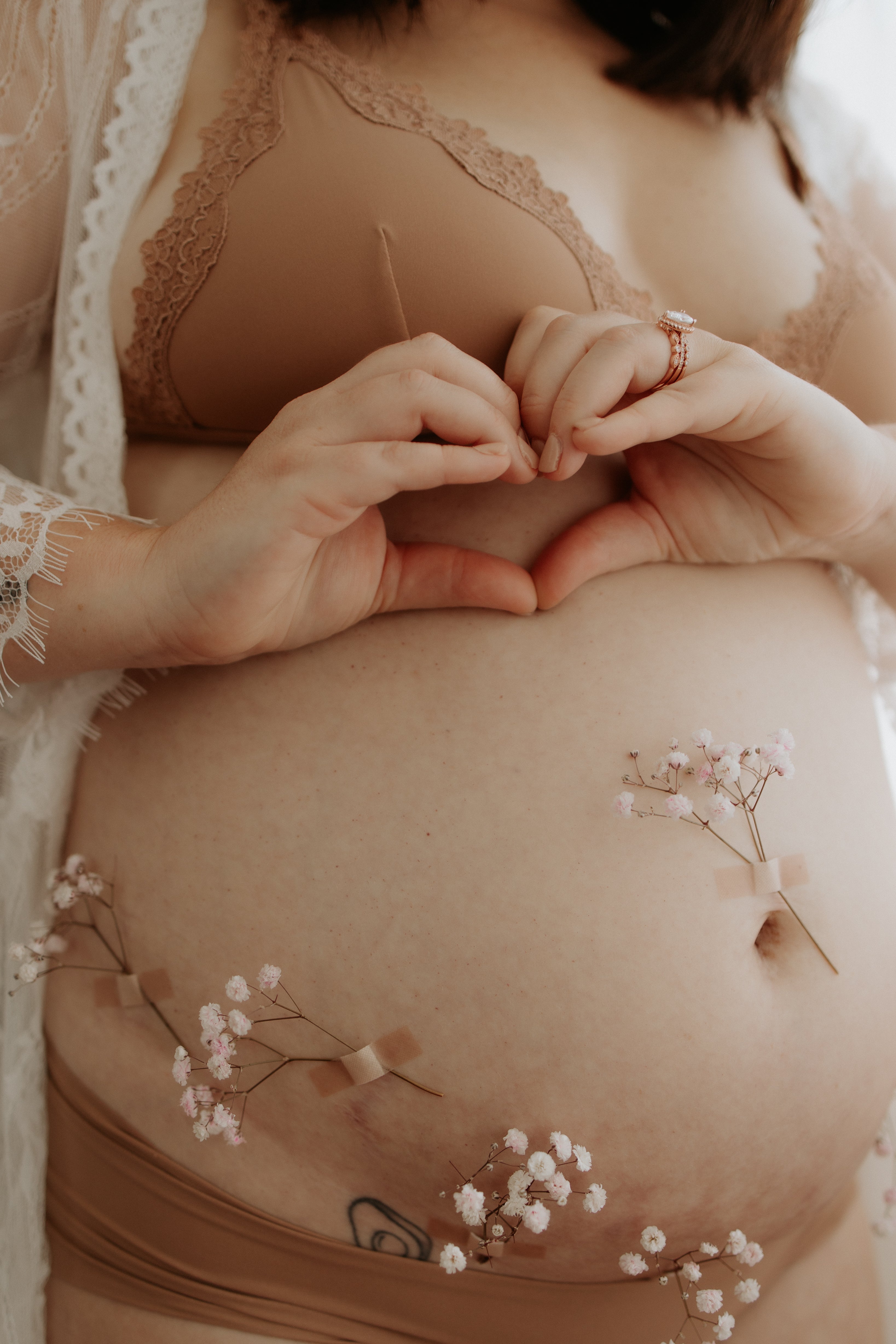 Post Endometriosis excision surgery tips